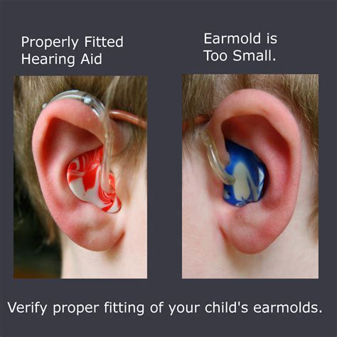 Fitting Infant Hearing Aids .